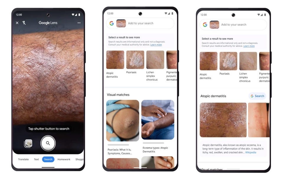 You Can Now Look Up Skin Conditions Using Google Lens on Your Phone | by  Kristina Confer | Medium