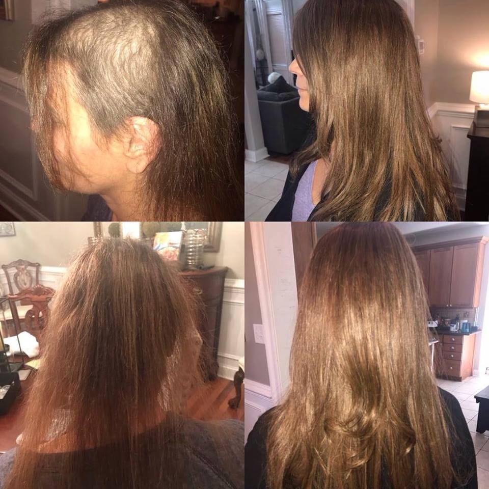 7 Hair Options for Cancer Patients How to Choose — Extension Fit