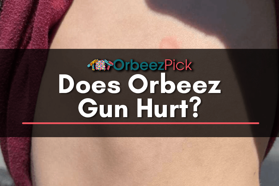 Does Orbeez Gun Hurt? [2023] by OrbeezPick Jul, 2023 Medium