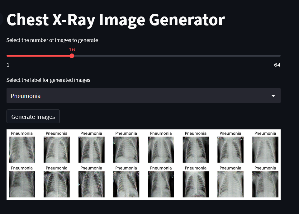 Building a Chest XRay Image Generator Using GANs by CodeAIGo Sep