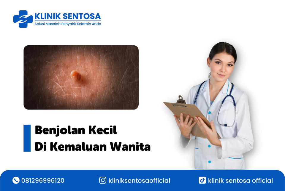 Benjolan Kecil Di Kemaluan Wanita | by klinik utama sentosa | Medium