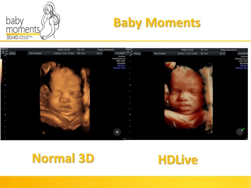 how much are 4d baby scans Scand Medium