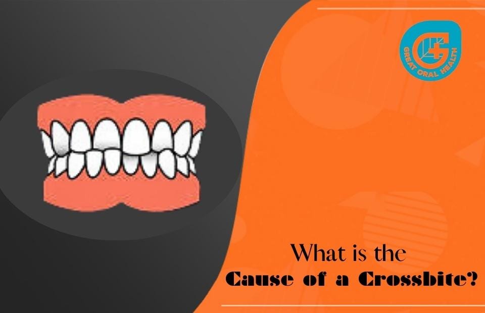 What is the Cause of a Crossbite? Great Oral Health Medium
