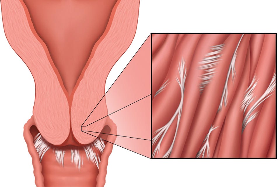 The Role of the Cervix in Menstrual Pain