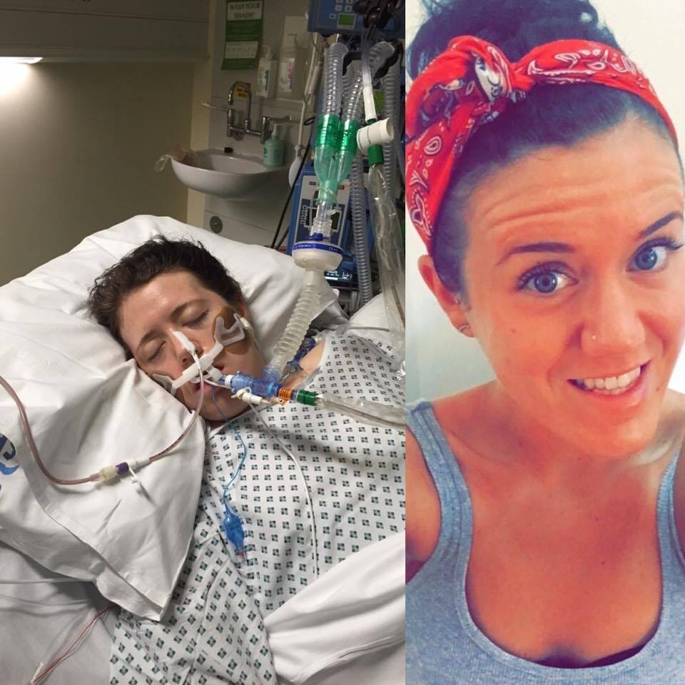 Sepsis Survivor my ongoing recovery by Laura Fraser Medium