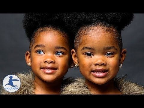 Untold facts behind black Africans with blue eyes