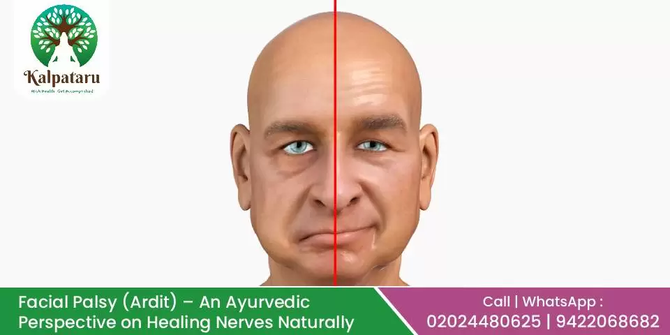 Facial Palsy (Ardit) — An Ayurvedic Perspective on Healing Nerves Naturally