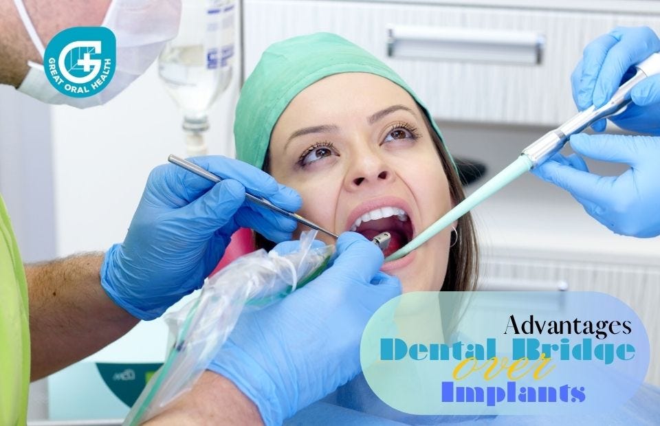 Advantages of Dental Bridges over Dental Implants - Great Oral Health