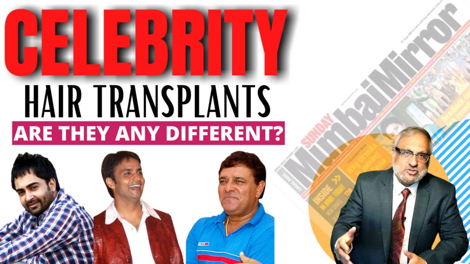 Celebrity Hair Transplant: Challenges | by Darlingbuds1 | Medium