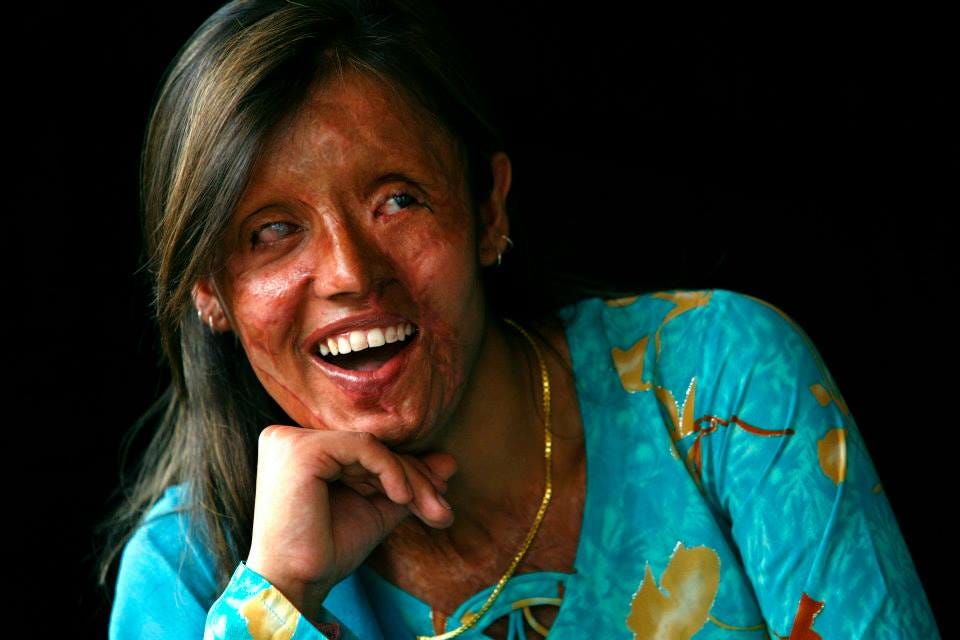 Tackling acid violence to ensure justice for survivors by Trang Chu