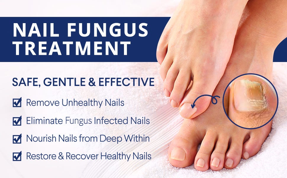 Nature’s Remedy Fungi Remover — Safe Kill Nail Fungus And Solution by