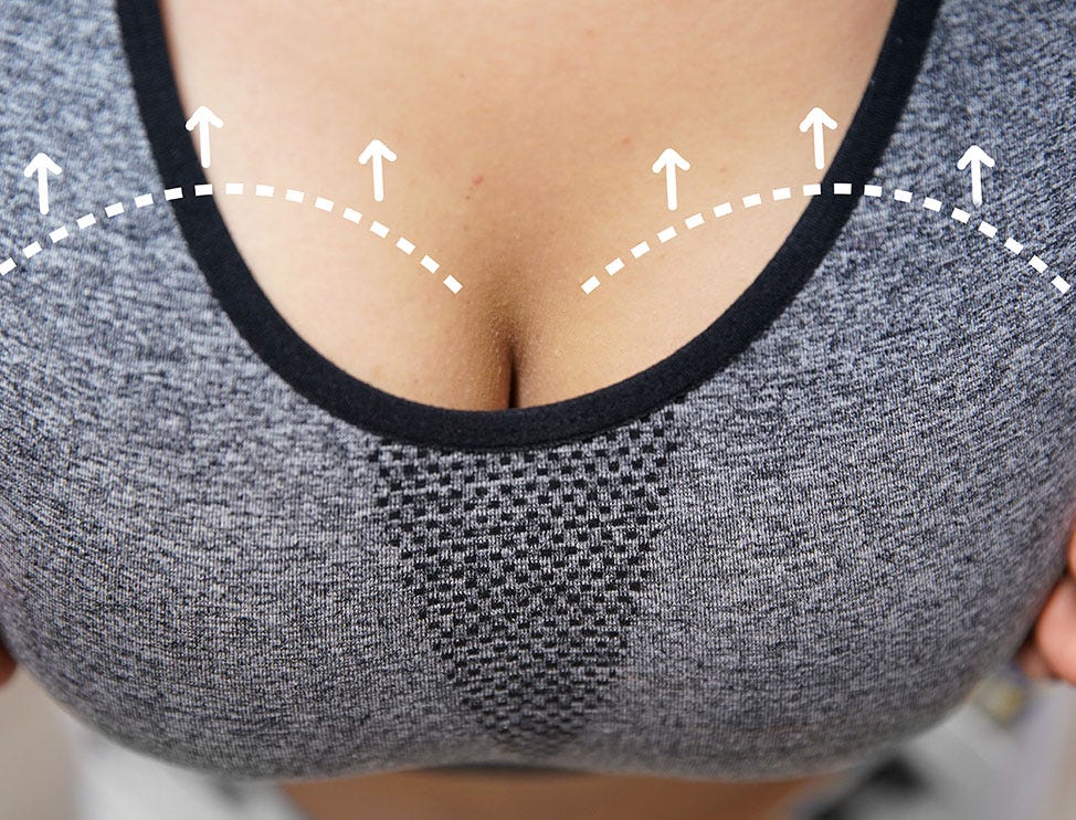 Can Breast Reduction Surgery Make Your Breasts Perky?, by Dr Priya Bansal