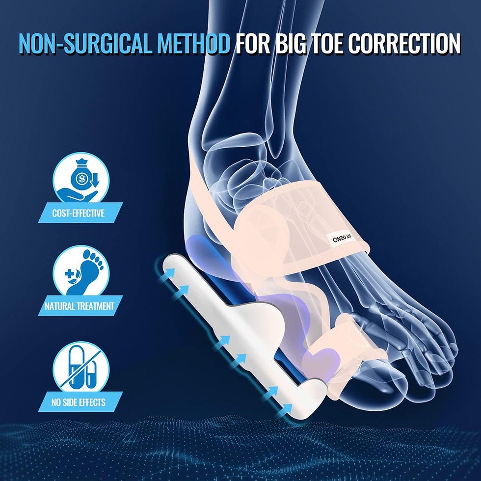 How Long Does It Take for Bunion Splint to Correct Fast Track Relief