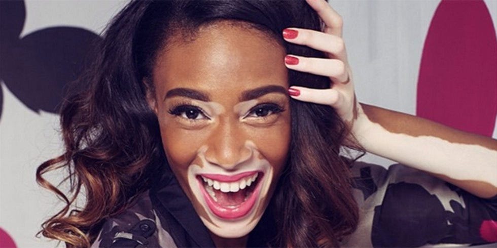 Winnie Harlow is Starting a Discussion About Image, Race, and Ownership |  by SmartGirls Staff | Amy Poehler's Smart Girls