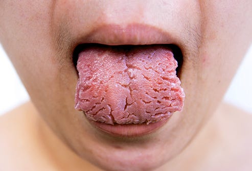 What Your Tongue Tells You About Your Overall Health | by Dr. Steffany  Mohan, DDS | Medium