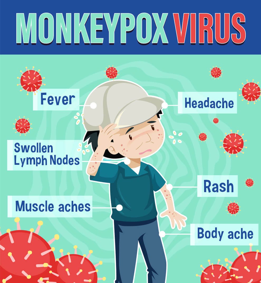 Monkeypox 101: Symptoms, Treatment, and Prevention